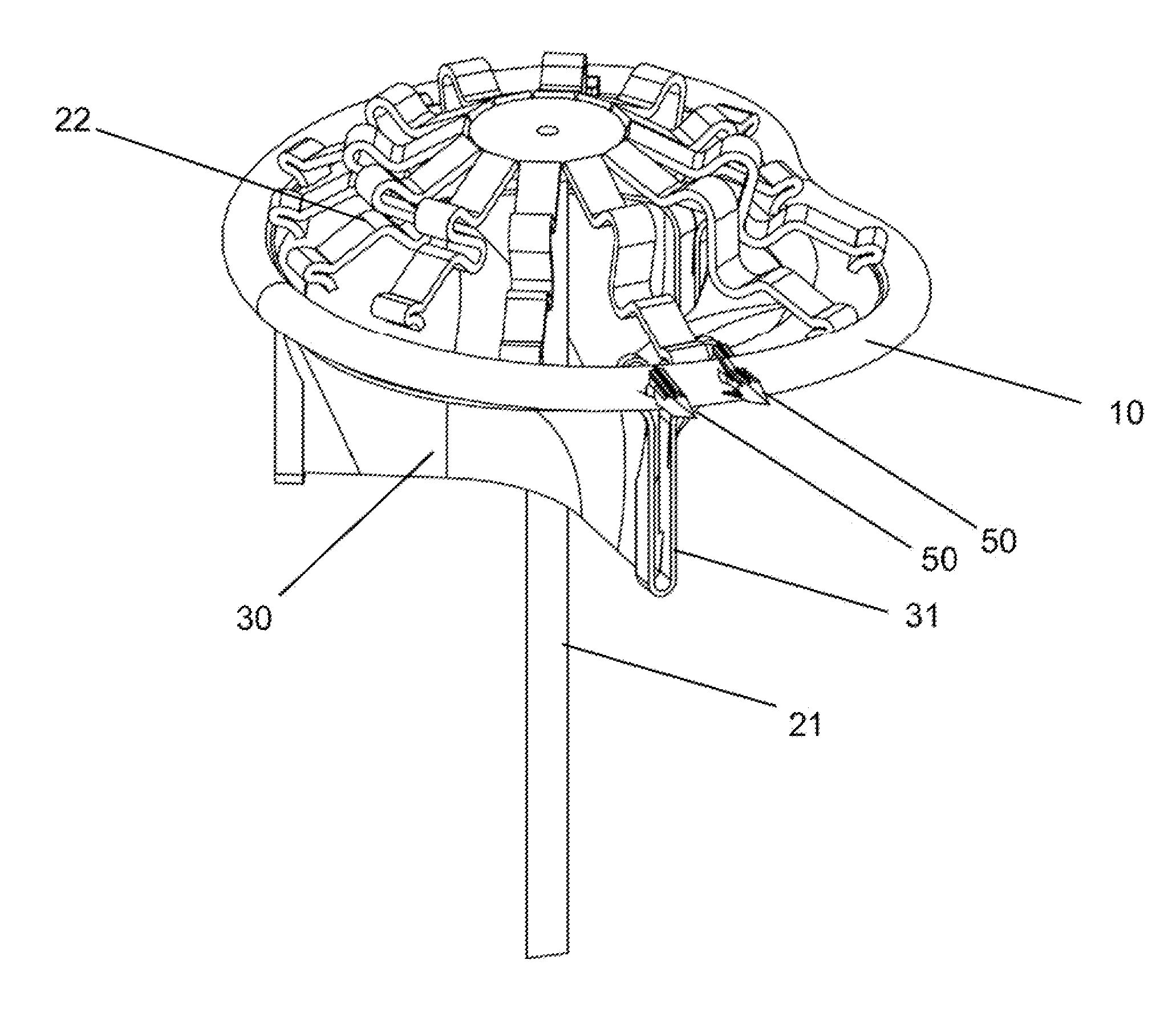 System and Method for Heart Valve Anchoring