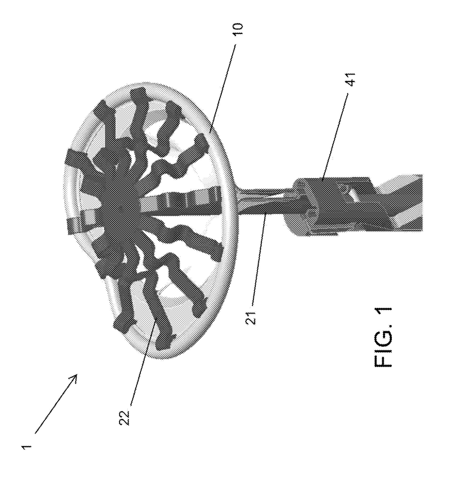 System and Method for Heart Valve Anchoring