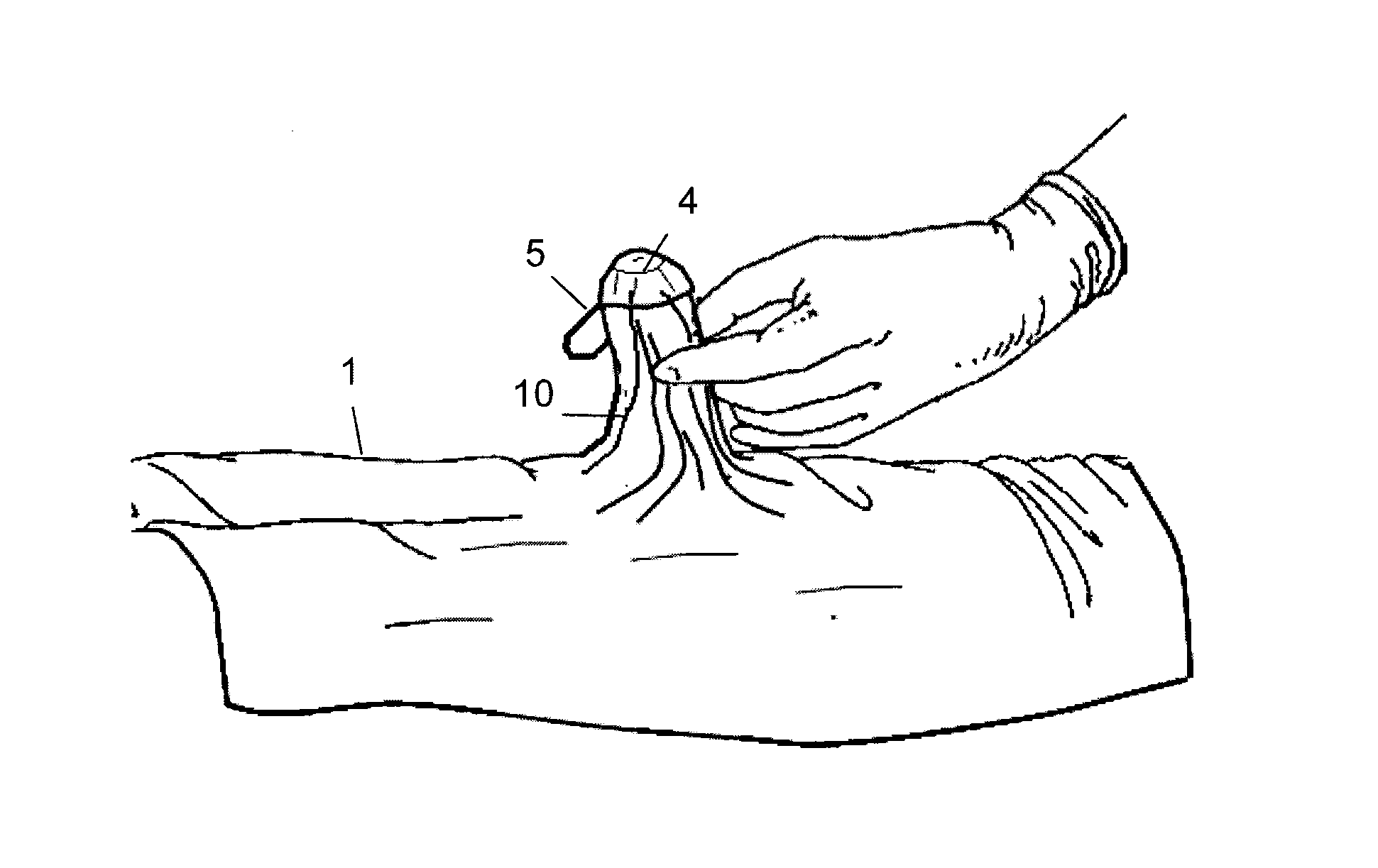 Surgical drape system for urology procedures on male patients