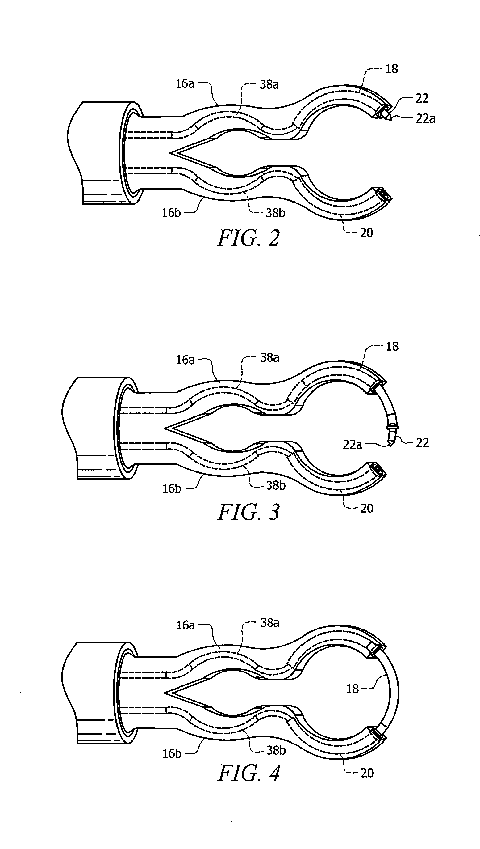 Universal laparoscopic suturing device