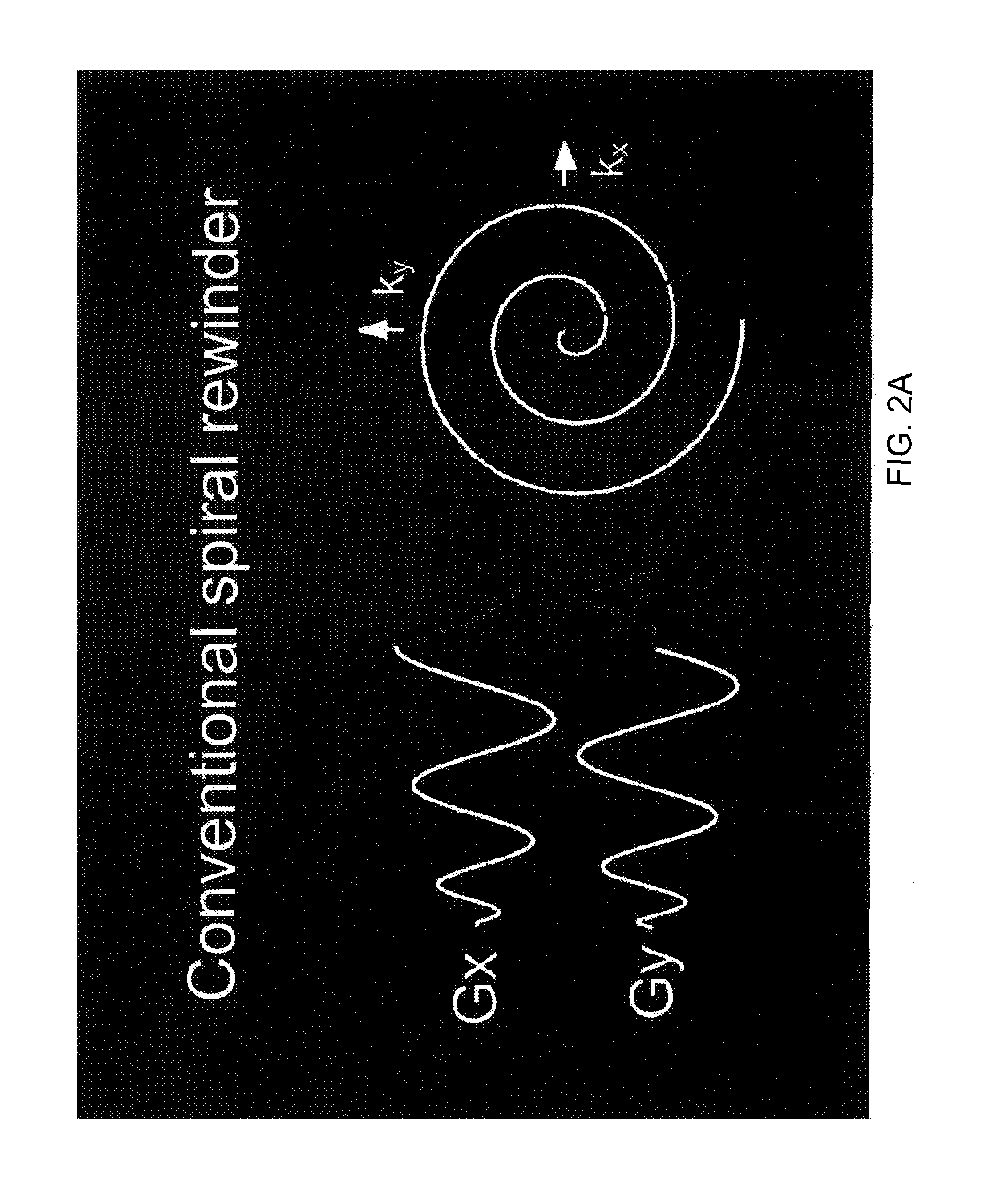 Motion compensated spiral FISP MRI