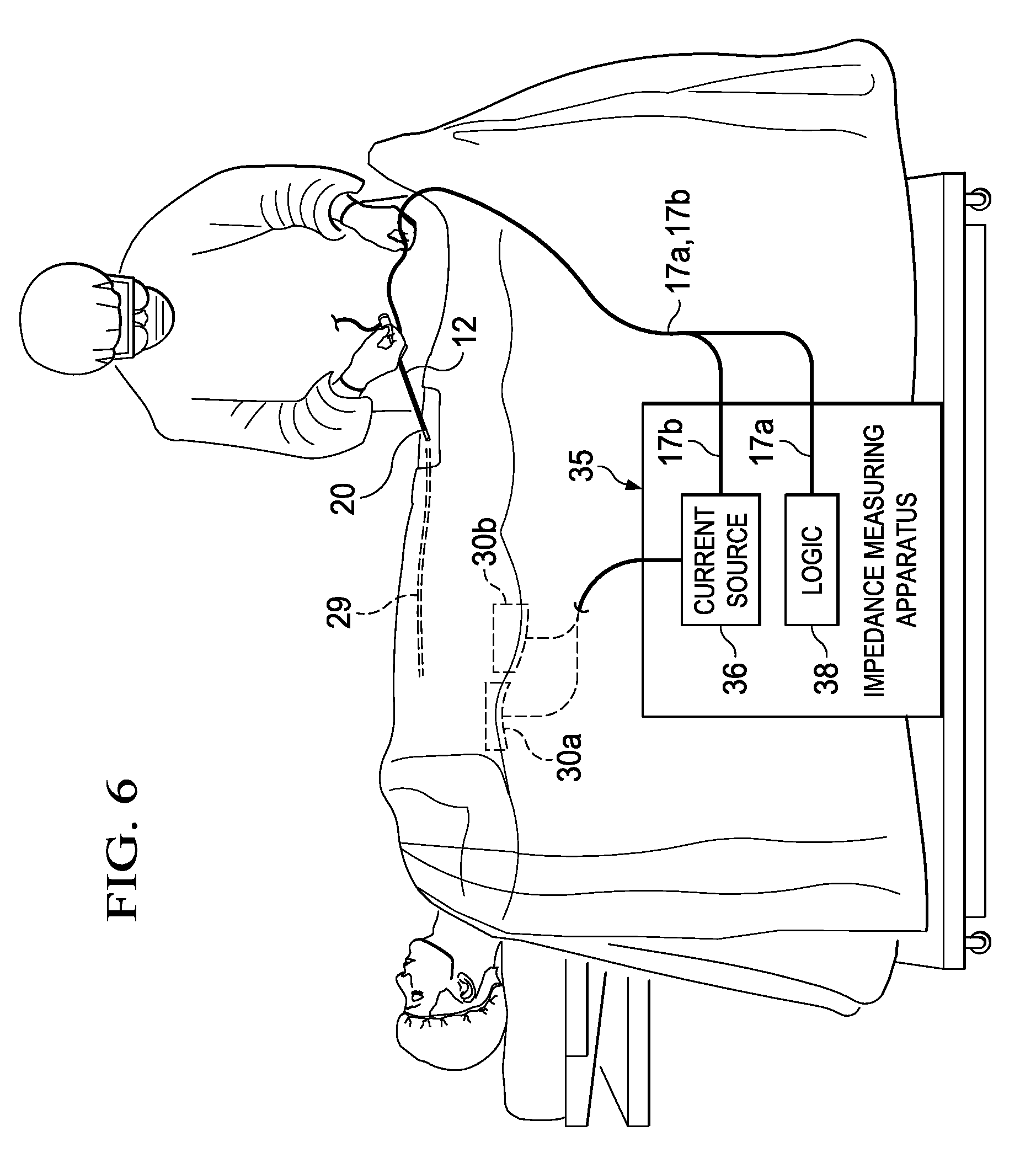 Introducer sheath with electrodes