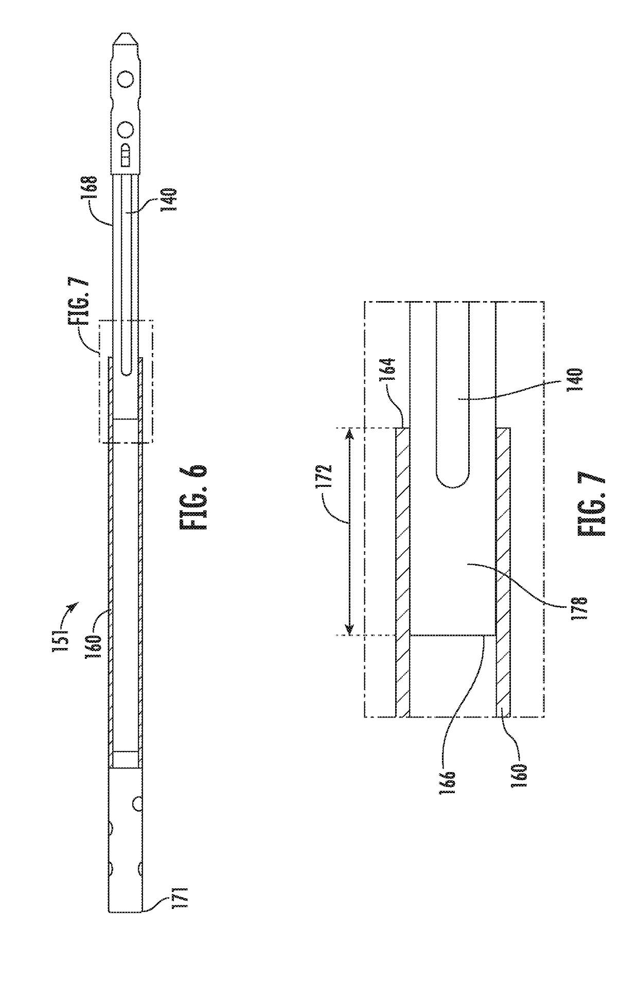 Implantable bone adjustment devices