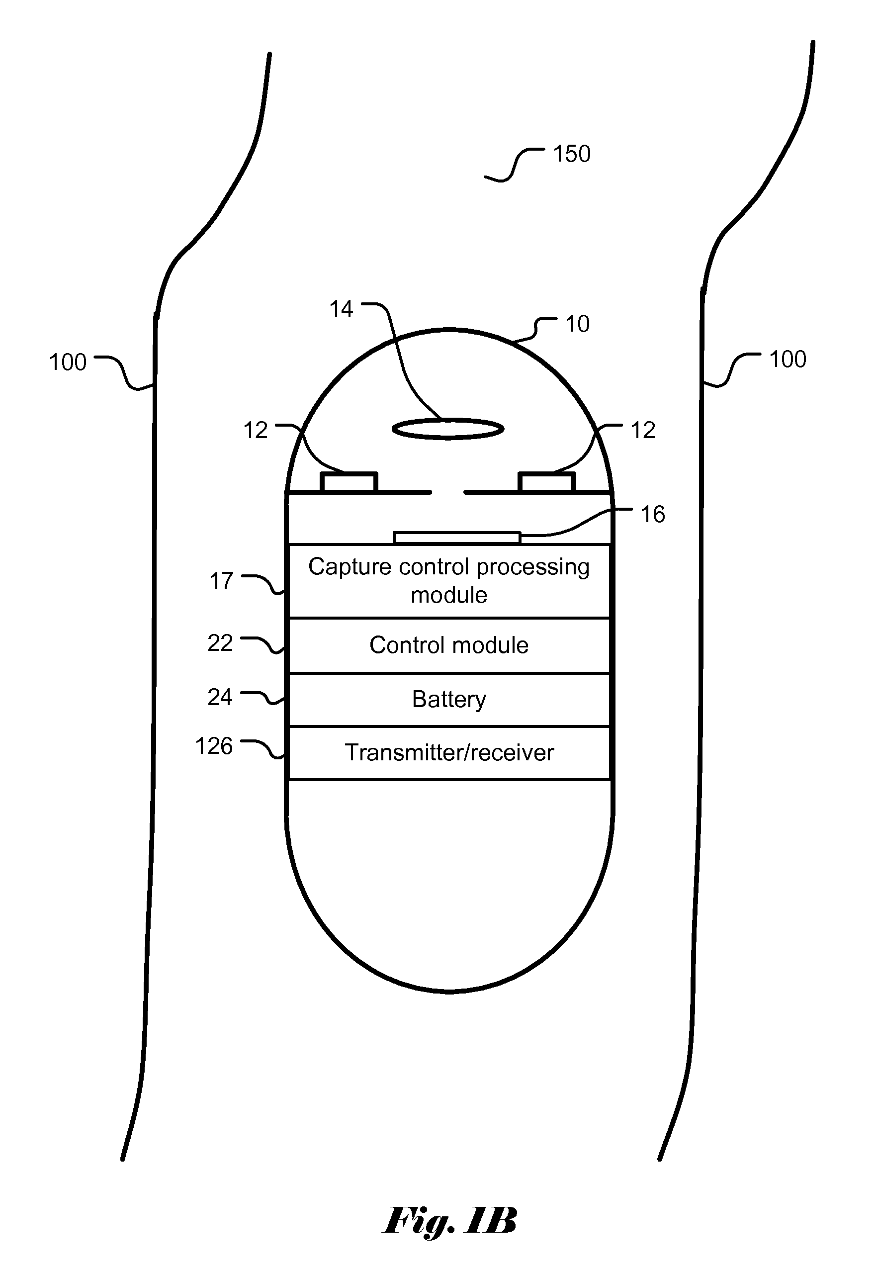 Capture control for in vivo camera