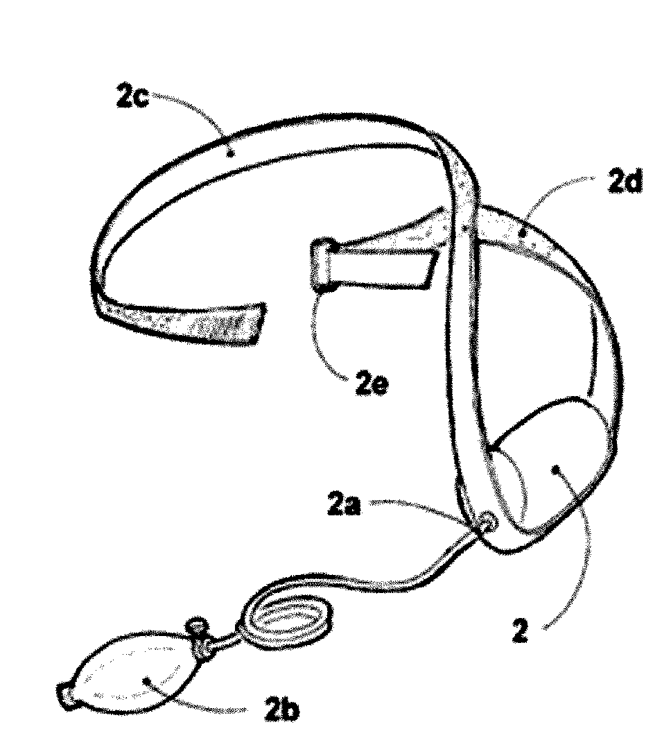 An orthopedic appliance and method to reduce anterior dislocation of shoulder and to provide post reduction immobilization