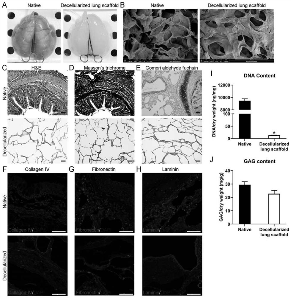 Method for culturing lung tumor organoids