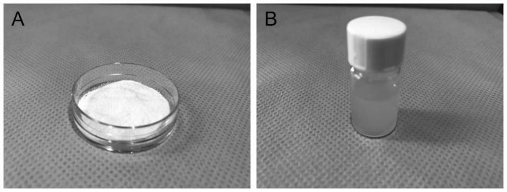 Method for culturing lung tumor organoids