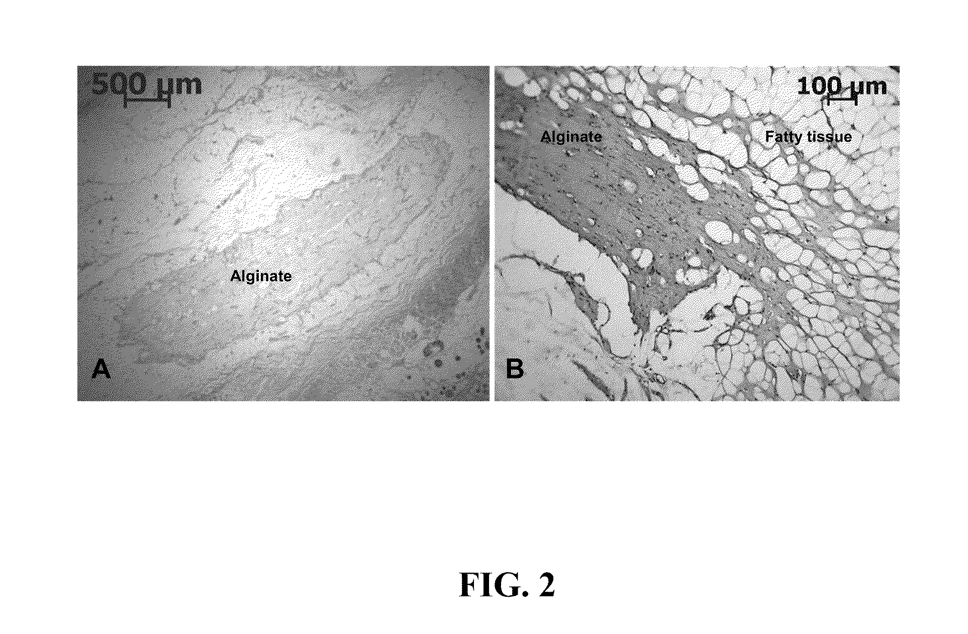 Monolithic in-situ cross-linked alginate implants