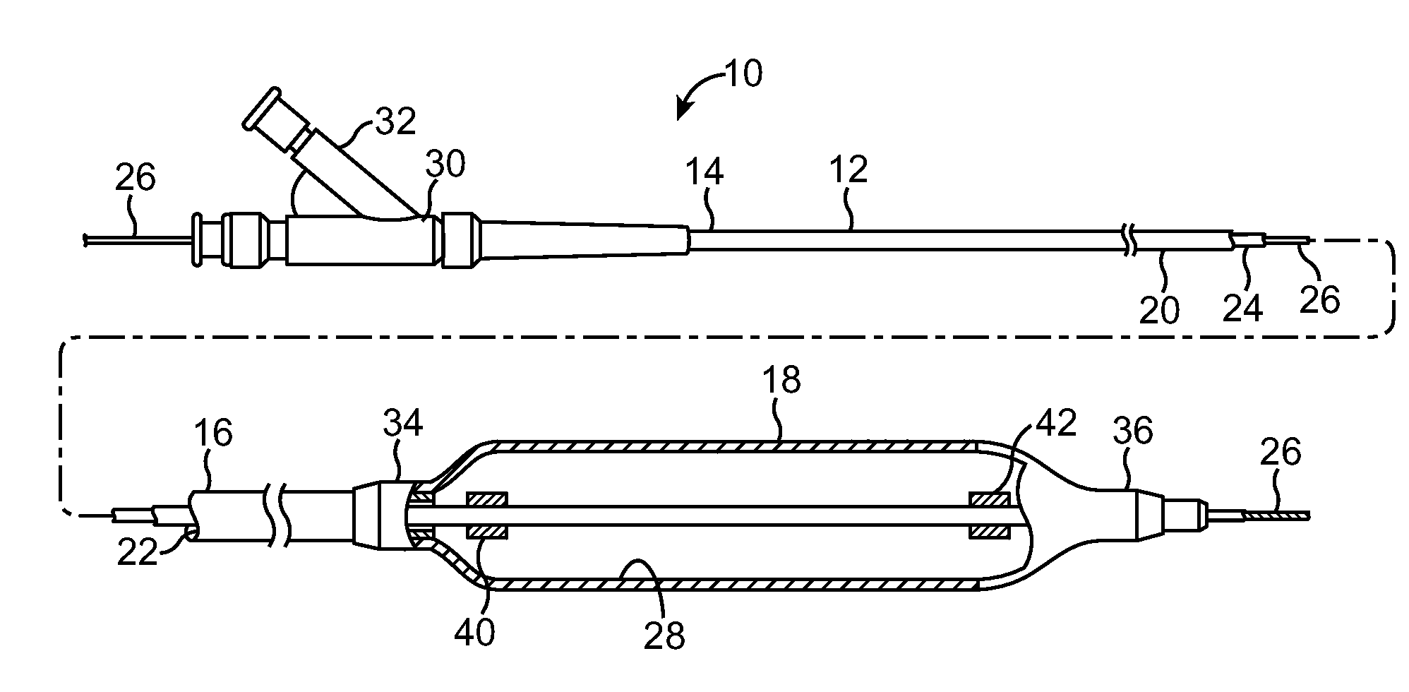 Self-Crimping Radiopaque marker