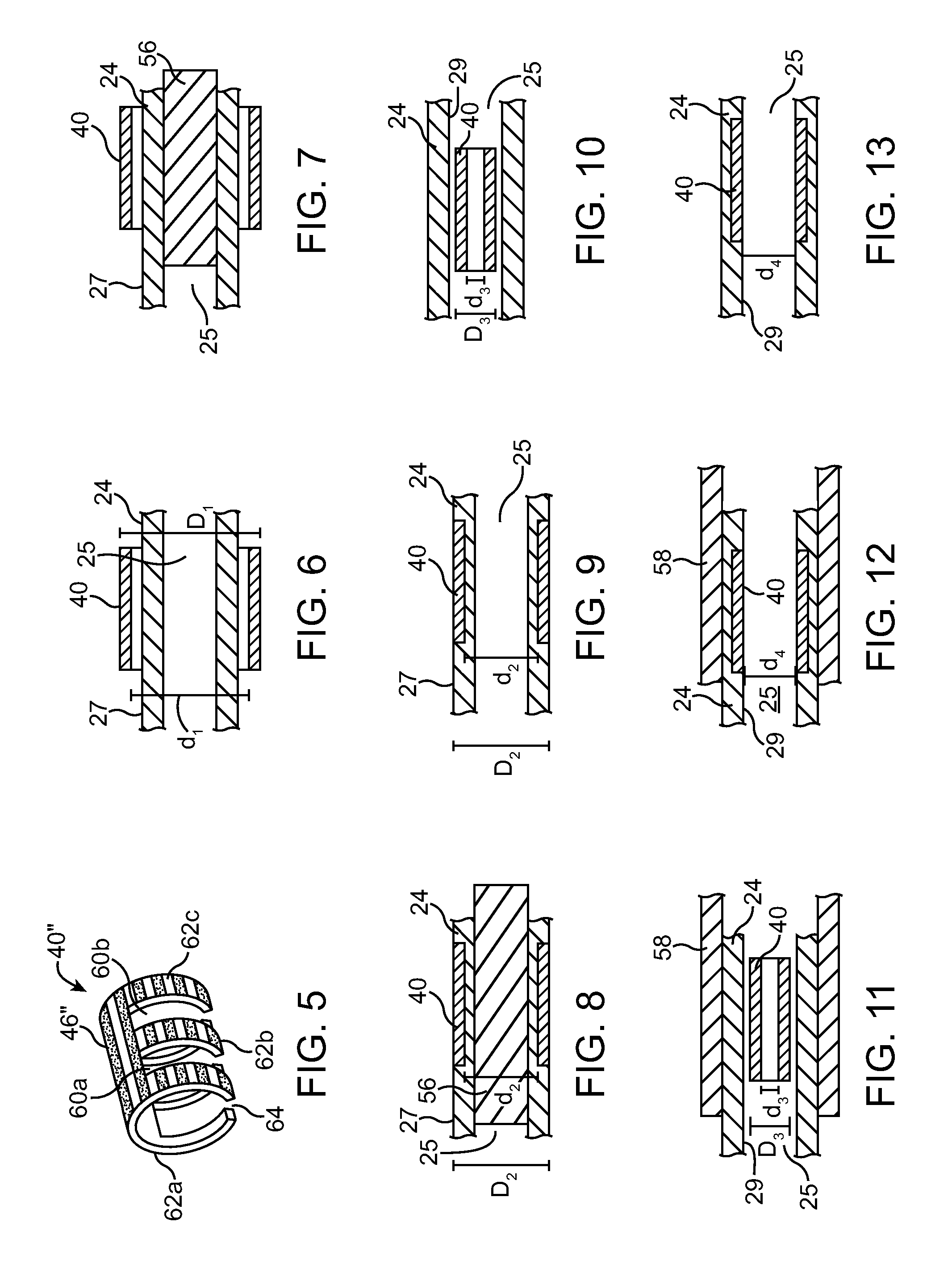 Self-Crimping Radiopaque marker