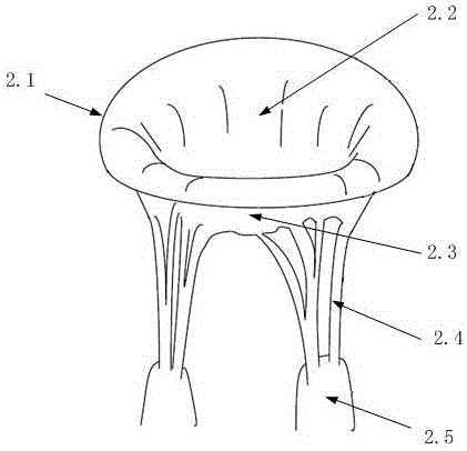 Mitral valve flexible closing plate blocking body implanted through cardiac apex and implantation method