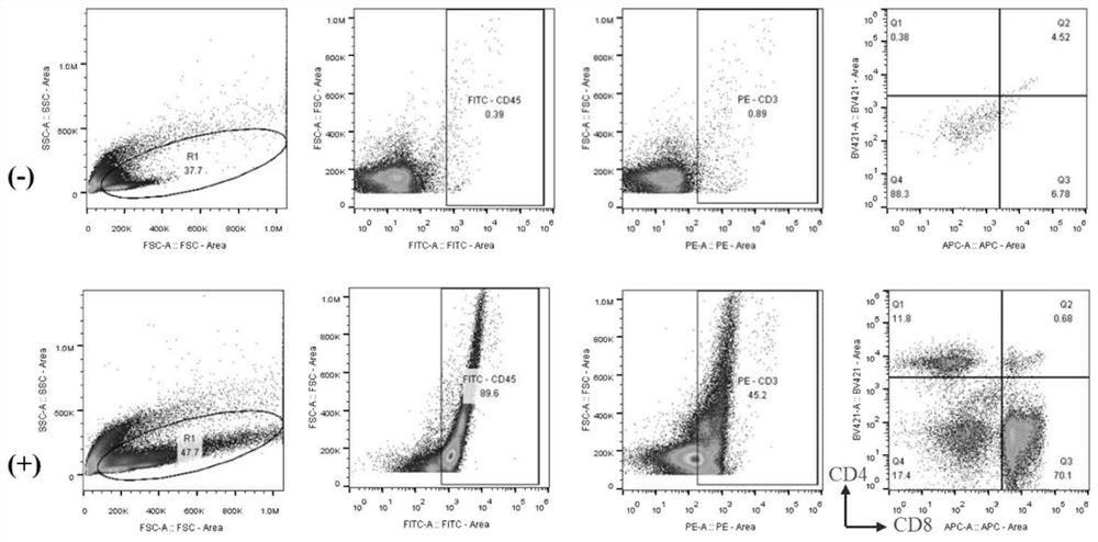 In-vitro amplification method and application of glioma-derived tumor infiltration lymphocytes (TIL)