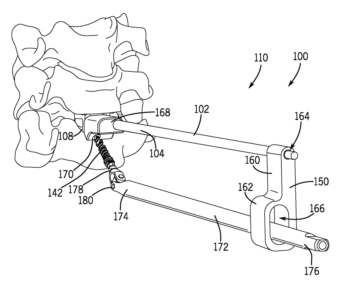 Spinal joint implant delivery device and system