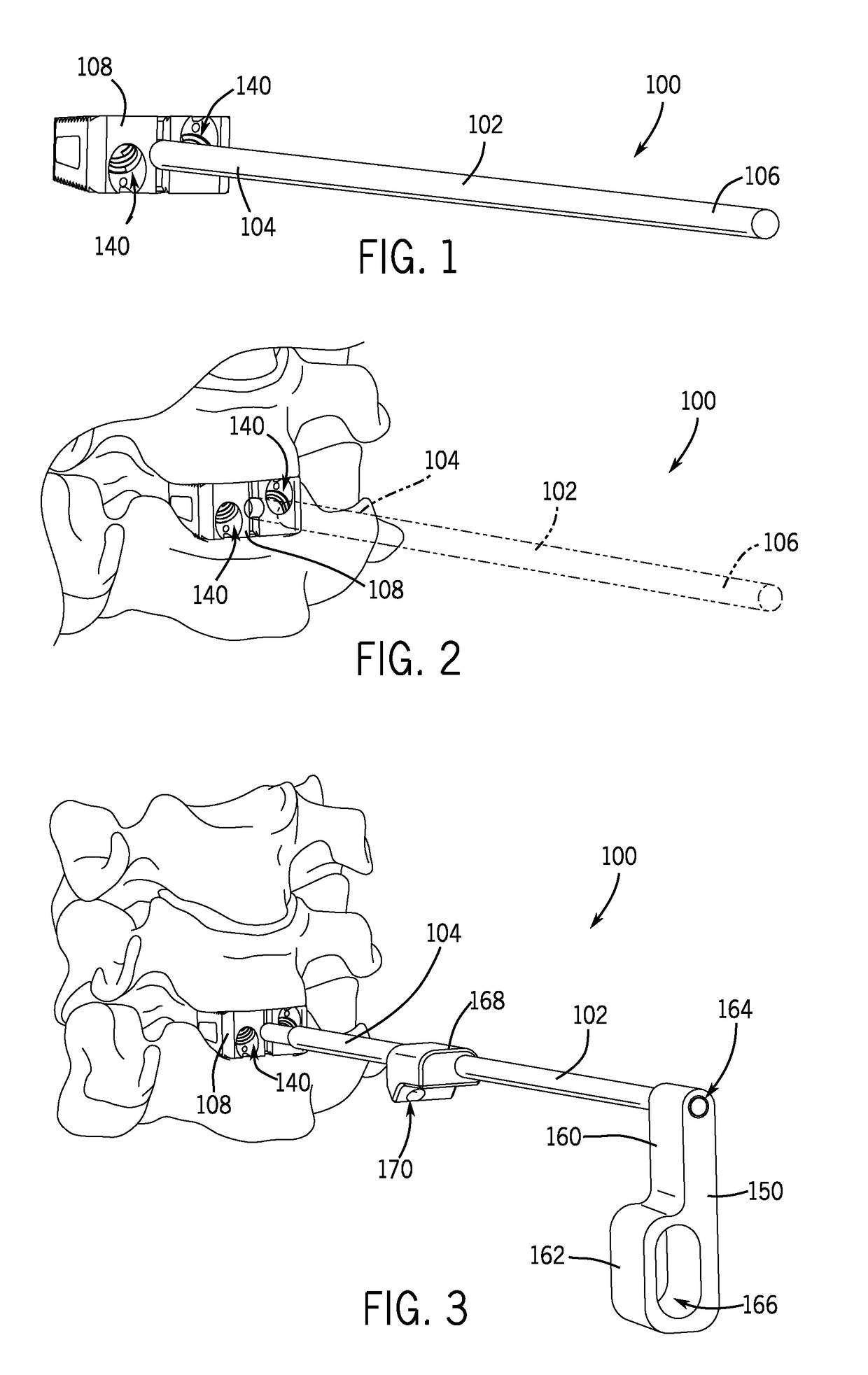 Spinal joint implant delivery device and system