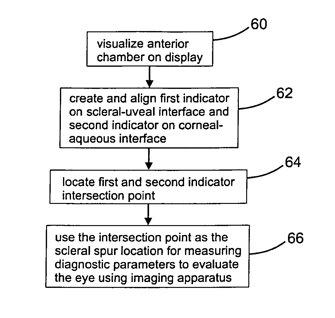 Methodology to identify the scleral spur