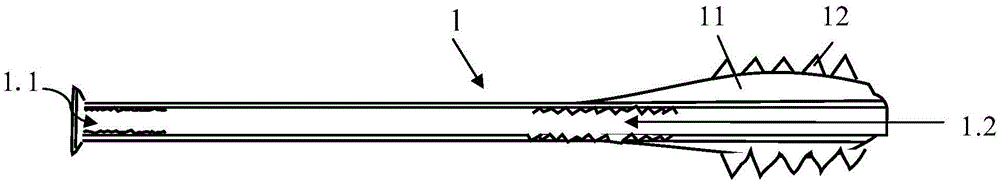 A pressurized intramedullary expansion locking nail and its manufacturing method