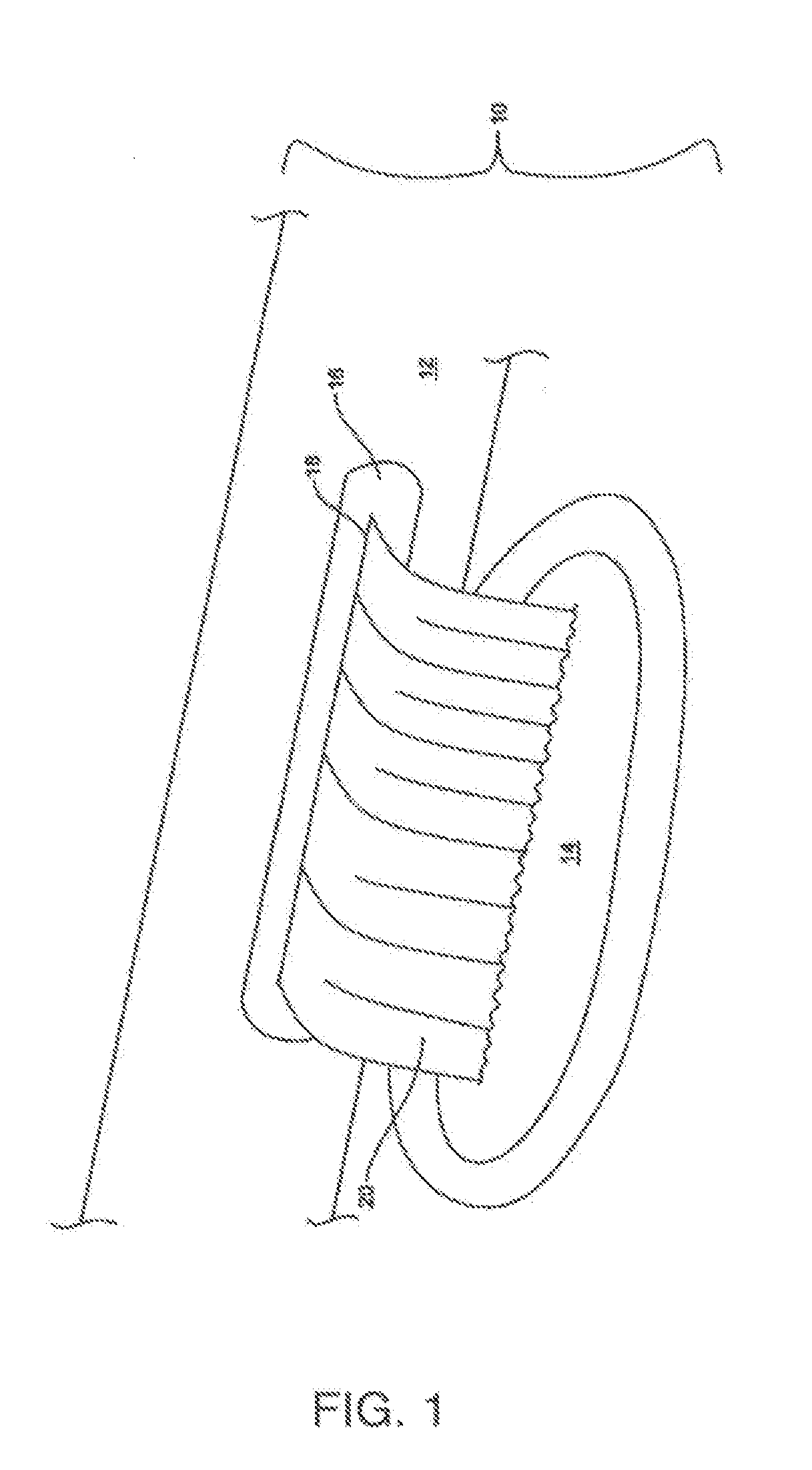 Waterfall waterjet with removable baffle