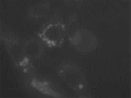 Novel fluorescent molecular probe and application thereof