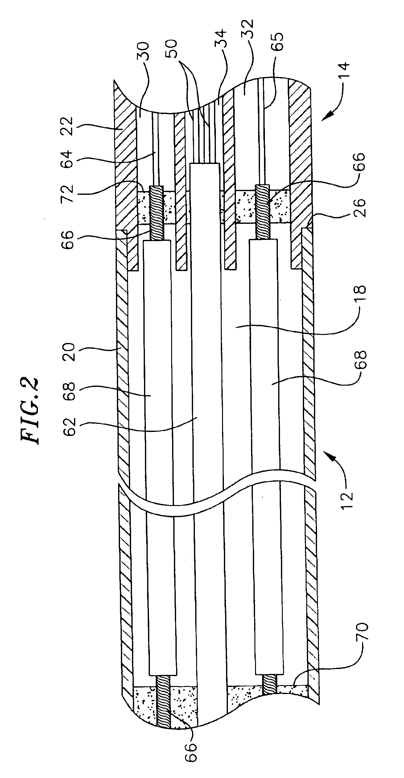 Dual-function catheter handle