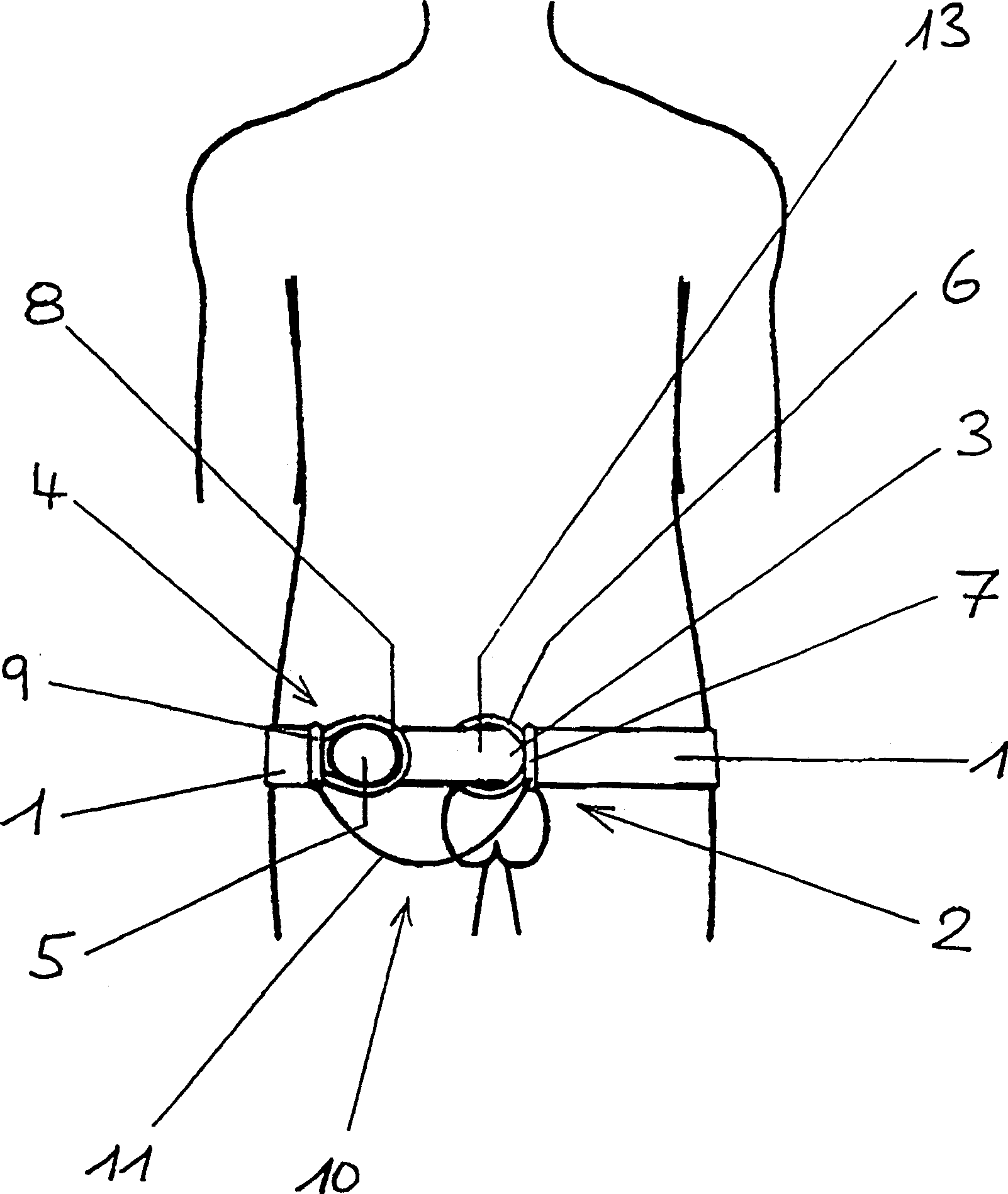 Penis extender