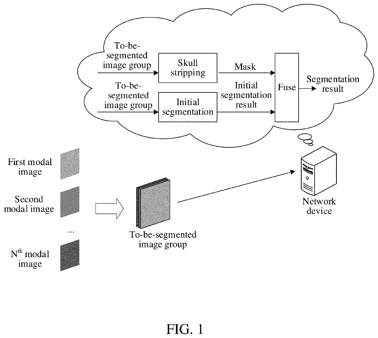 Brain image segmentation method and apparatus, network device, and storage medium