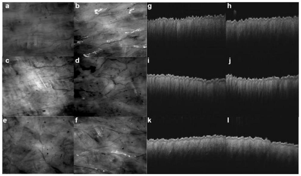 Skin blood vessel and blood flow quantitative evaluation system and method based on optical imaging