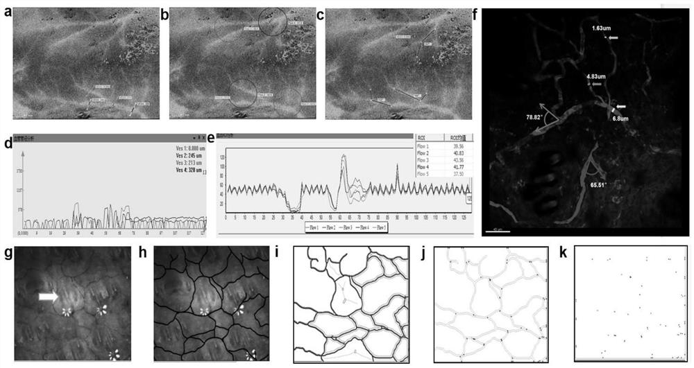 Skin blood vessel and blood flow quantitative evaluation system and method based on optical imaging