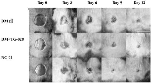 Treatment agent applied to prevention and/or treatment of foot diseases in diabetes