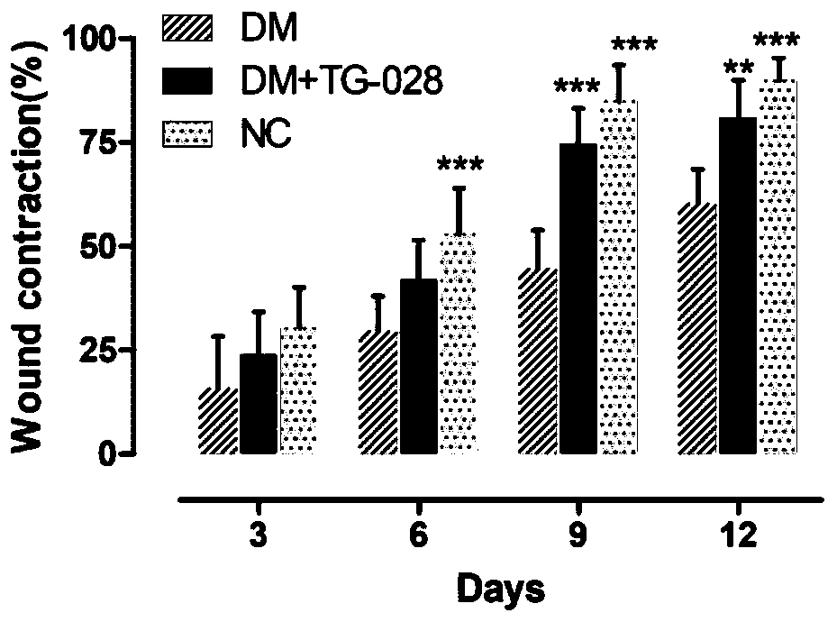 Treatment agent applied to prevention and/or treatment of foot diseases in diabetes