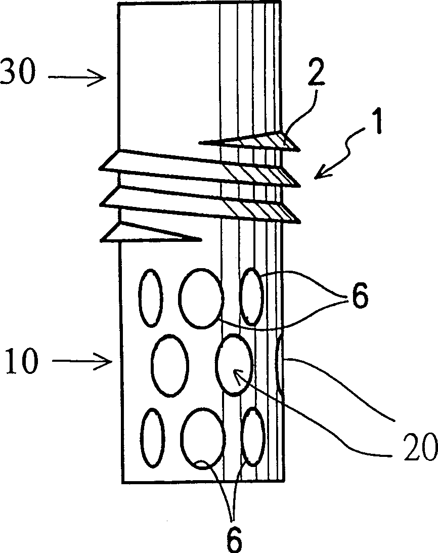 Dental implanting object containing calcium phosphate cementing agent