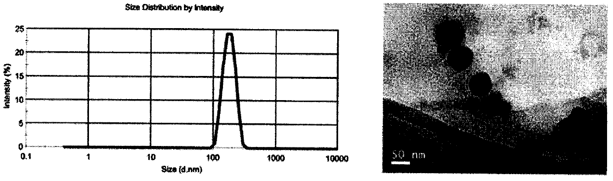 Macrophages membrane coated breast cancer targeted nanoparticles and preparation method thereof