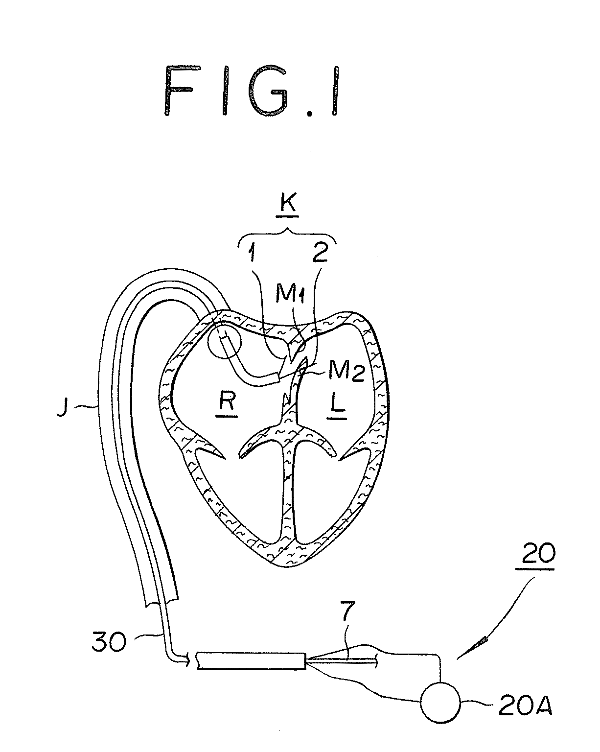 Medical device