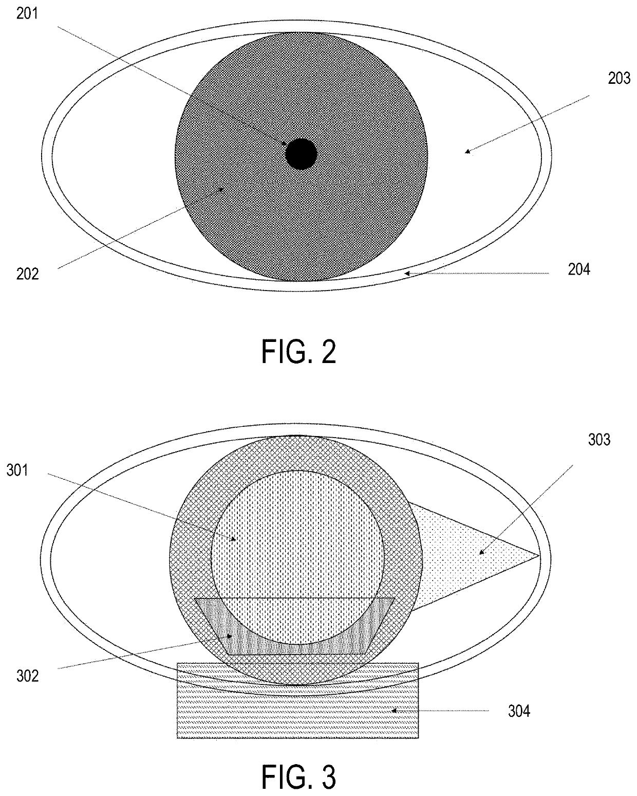 System and method for imaging, segmentation, temporal and spatial tracking, and analysis of visible and infrared images of ocular surface and eye adnexa