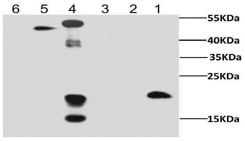 Preparation method and application of recombinant lactococcus lactis capable of displaying peanut allergen on surface