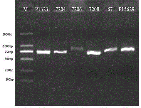 A kind of primer, method and kit for detecting hbv telbivudine resistance mutation