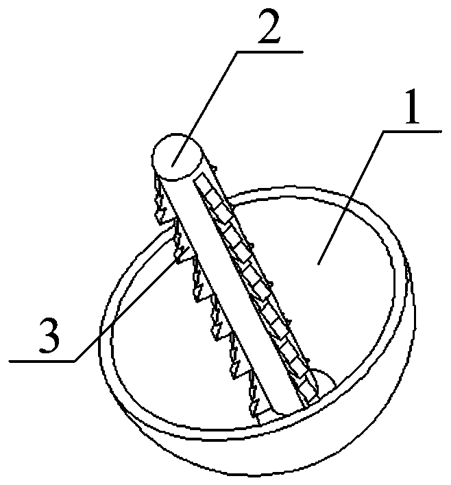 Caput femoris surface replacement prosthesis