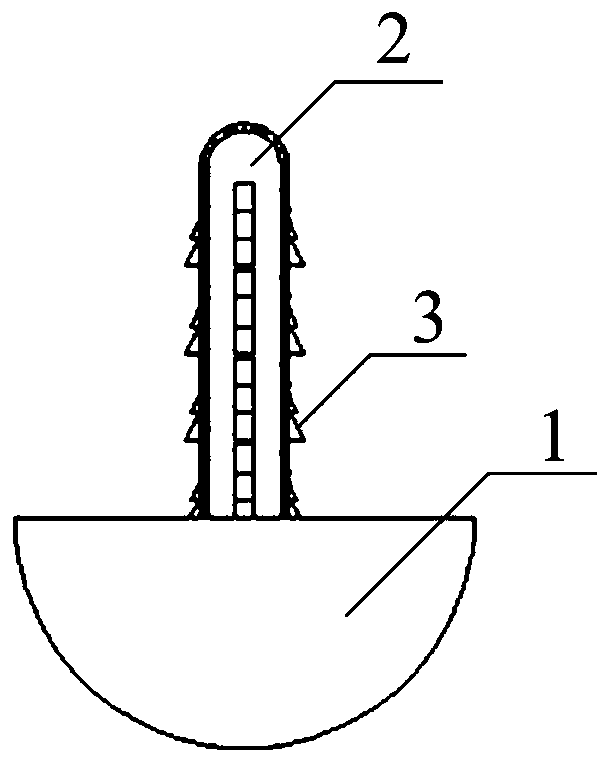 Caput femoris surface replacement prosthesis