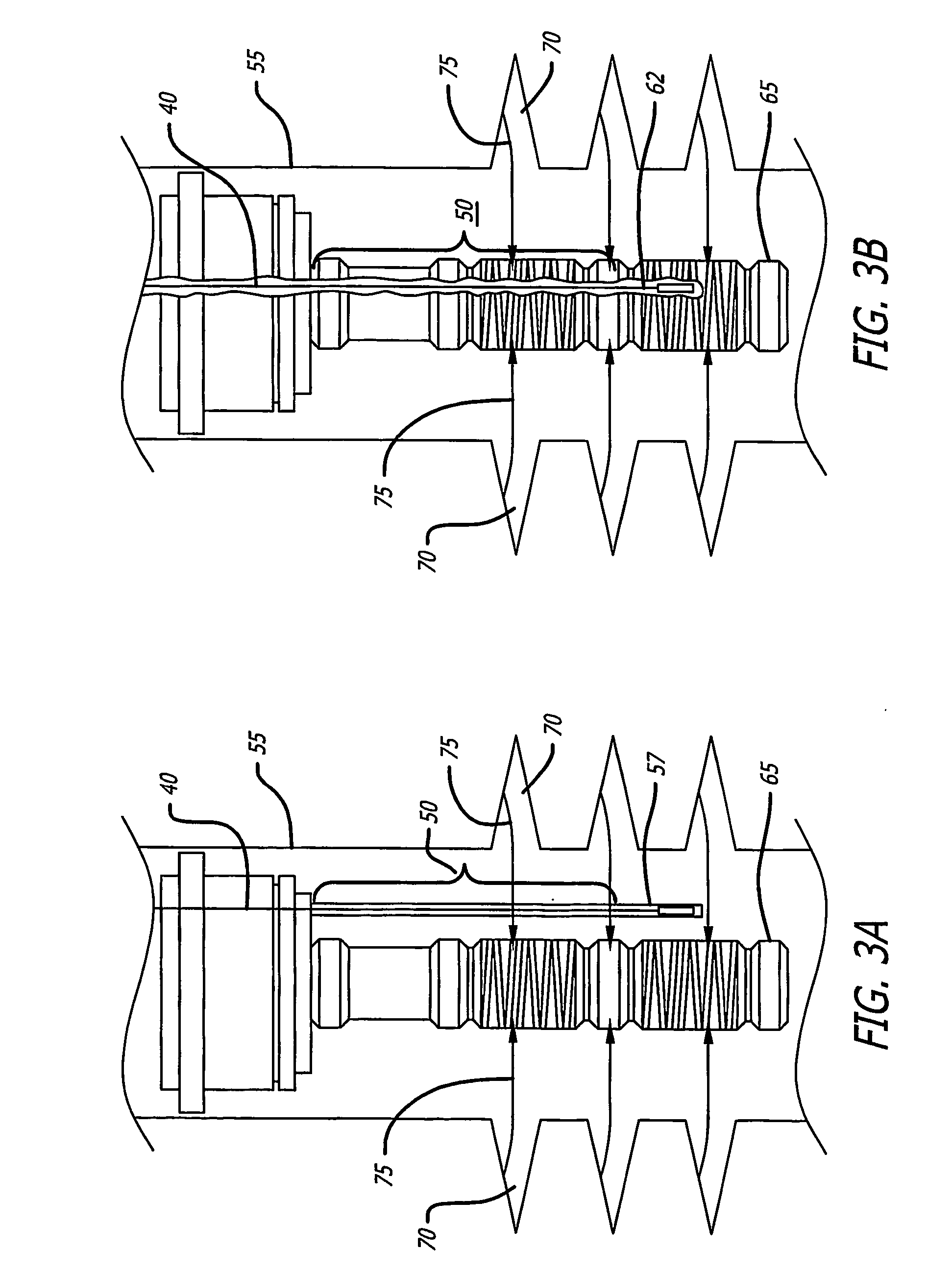 Downhole fiber optic acoustic sand detector