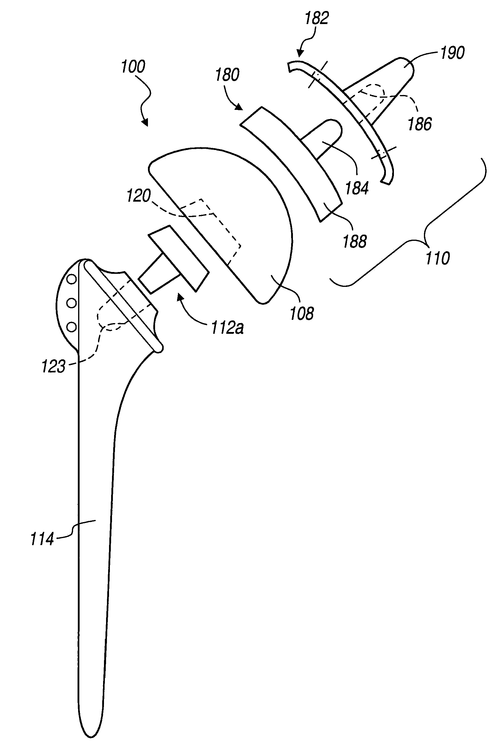 Shoulder Implant Assembly