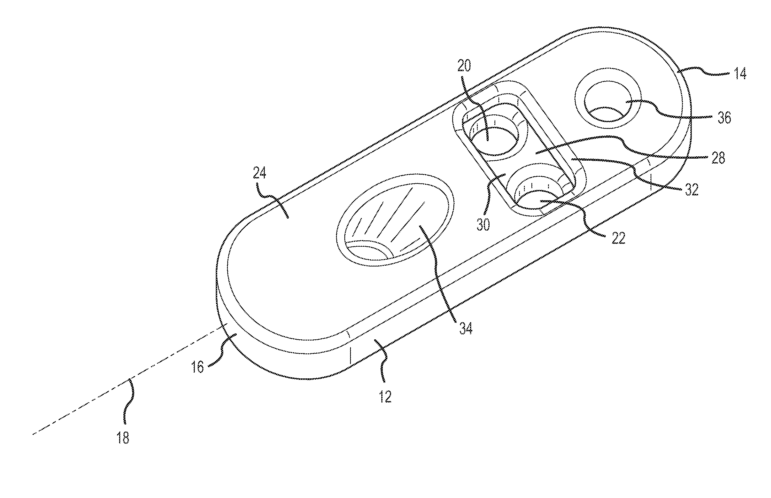 Suspensory graft fixation with adjustable loop length