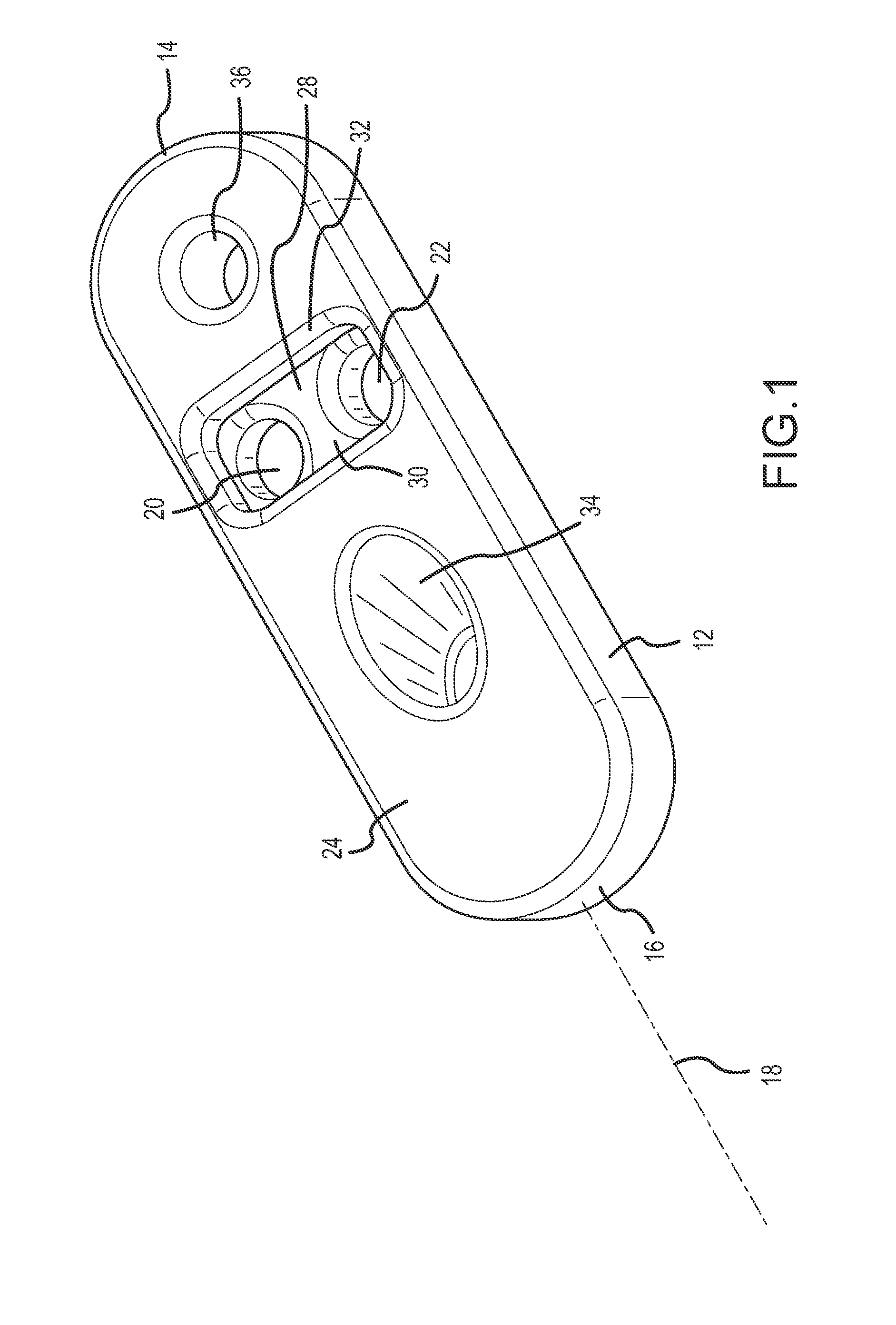 Suspensory graft fixation with adjustable loop length