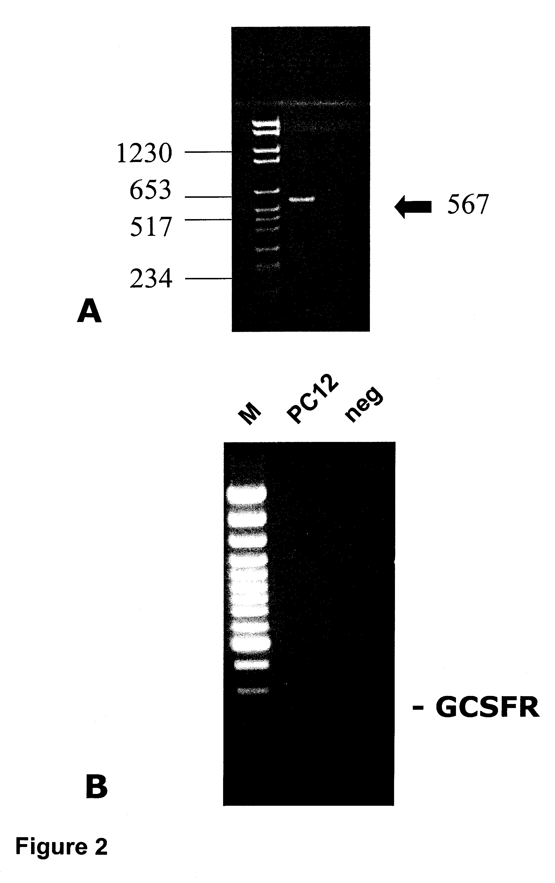 Methods of treating neurological conditions with hematopoeitic growth factors