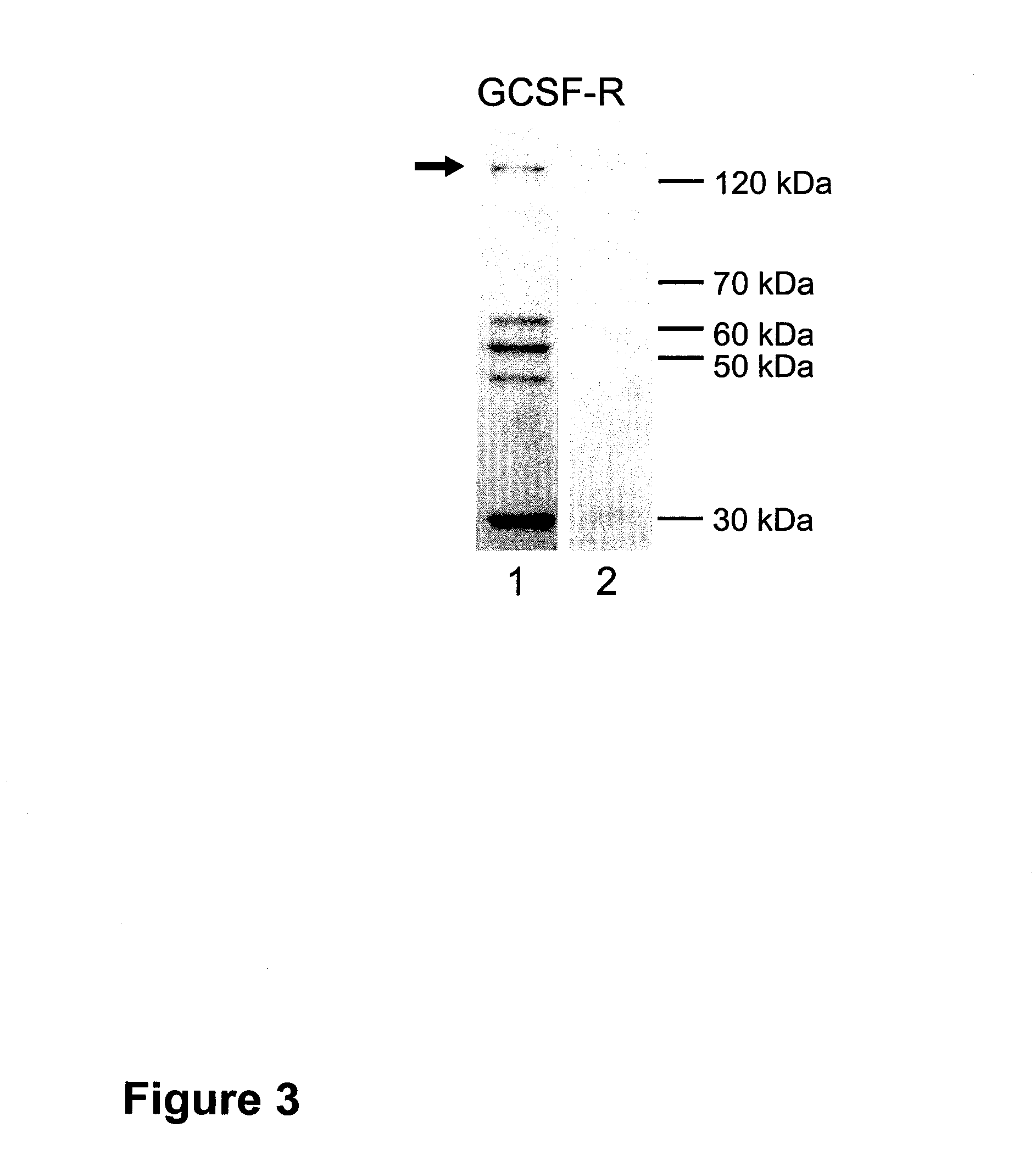 Methods of treating neurological conditions with hematopoeitic growth factors