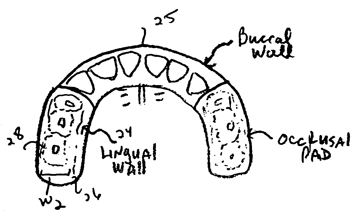 Dental appliance and mouthguard formed of polyolefin elastomer