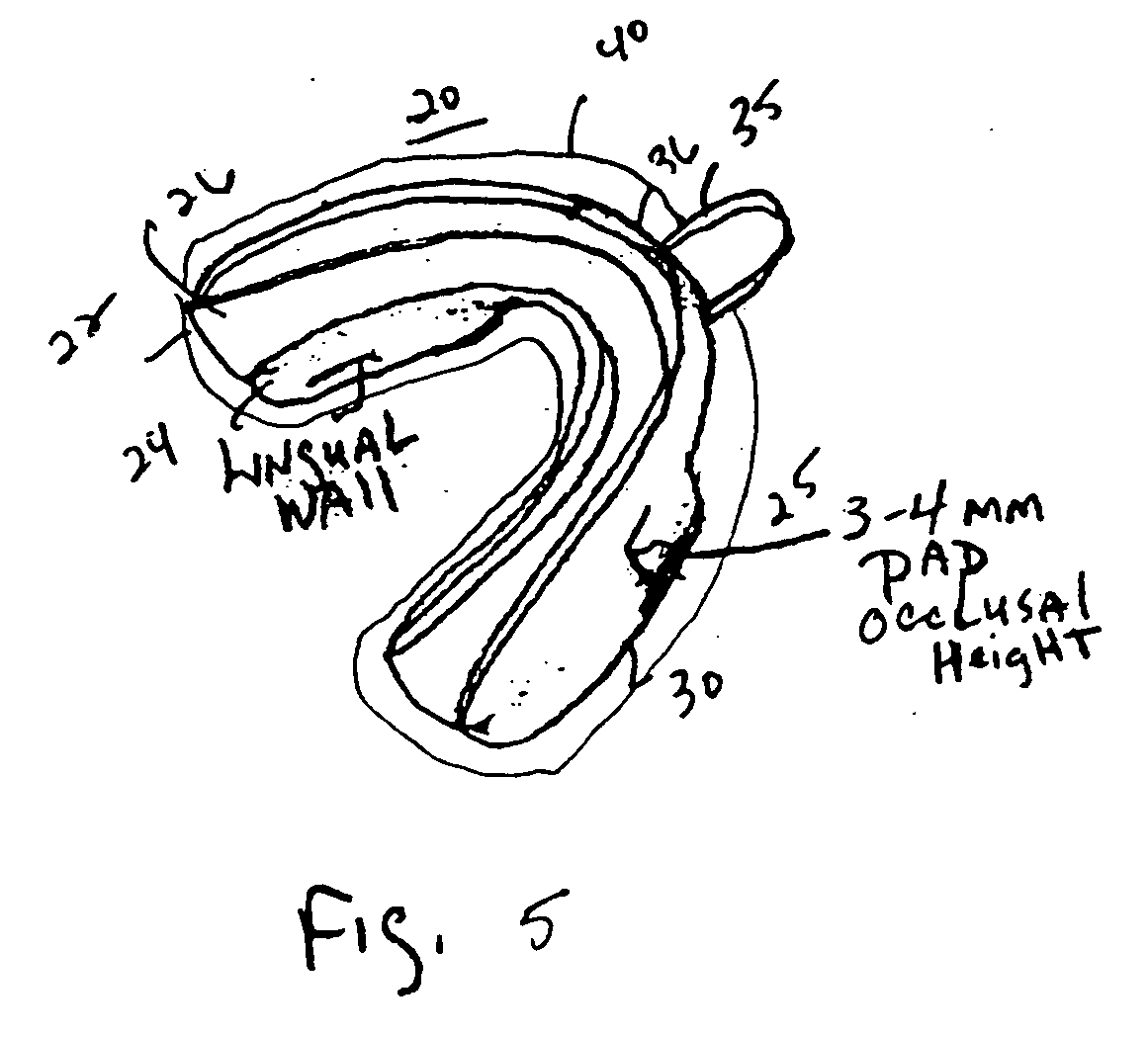 Dental appliance and mouthguard formed of polyolefin elastomer