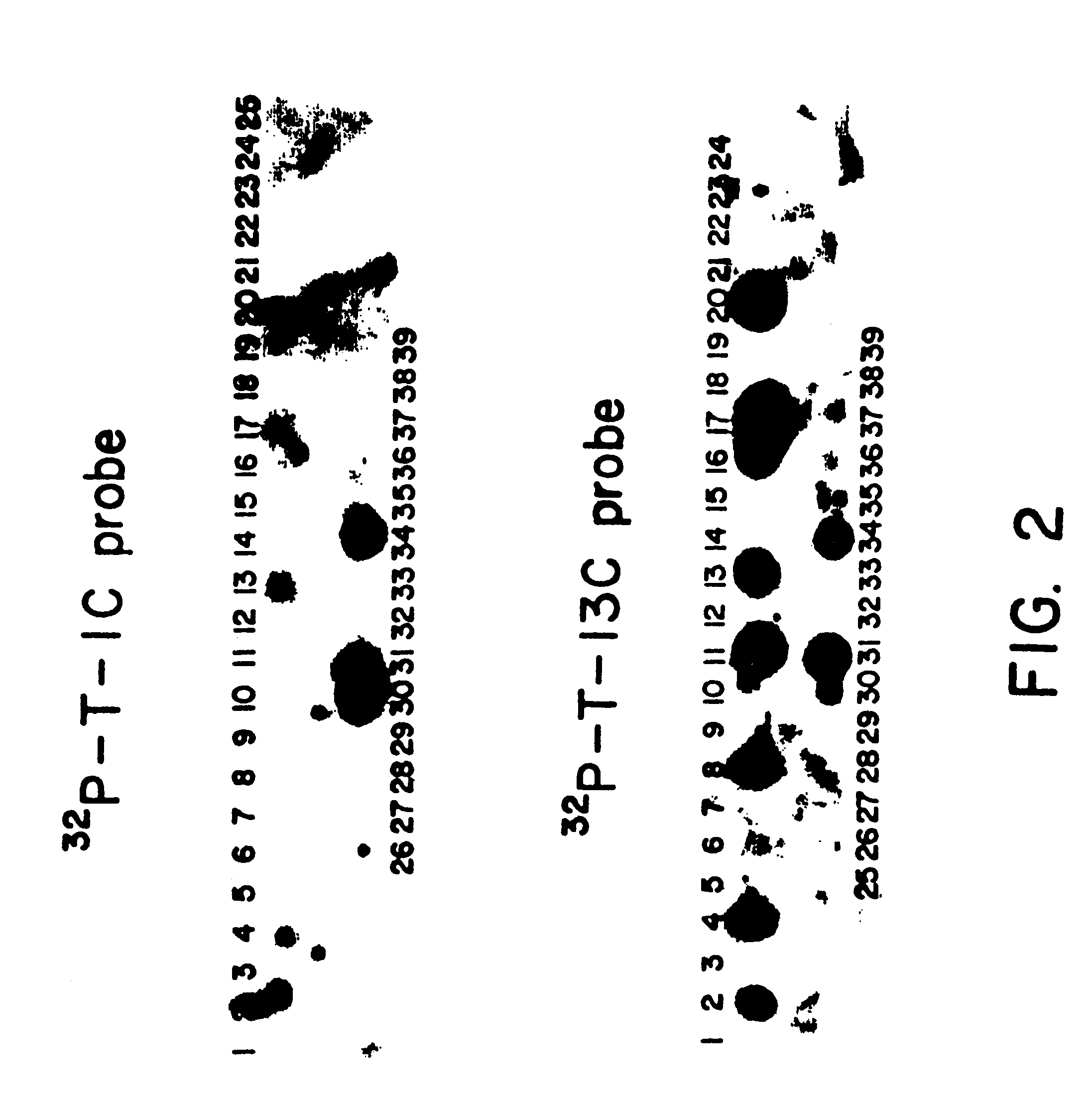 Microbial production of mature human leukocyte interferons