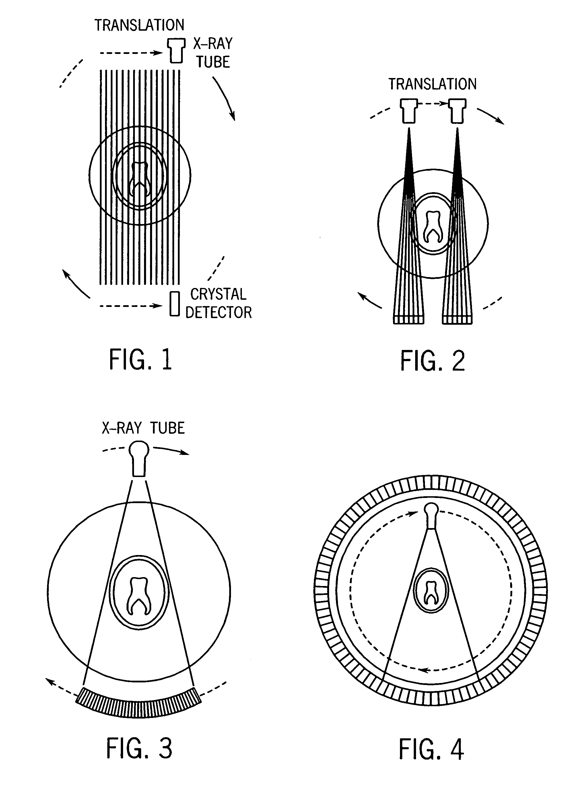 Fan-beam and cone-beam image reconstruction using filtered backprojection of differentiated projection data