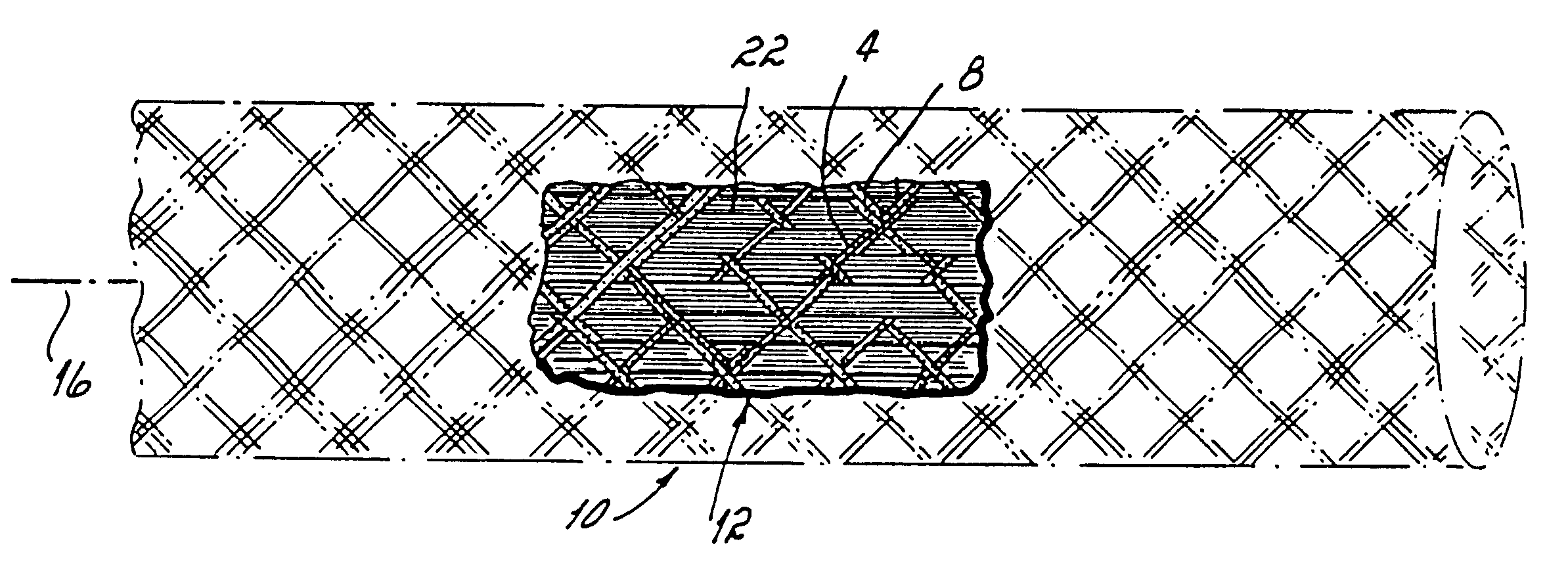 Braided structure with elastic bias strands