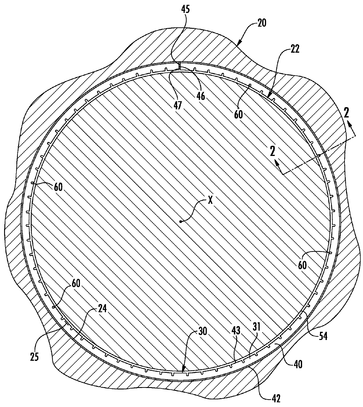 Radially notched piston rings