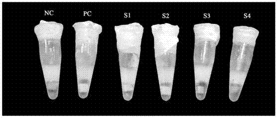 LAMP detection primers, system and method for detecting health state of exopalaemon carinicauda after WSSV (White Spot Syndrome Virus) infection